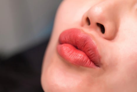 입꼬리보톡스 예쁜 미소 완성하는 차이의원 관련 이미지 2