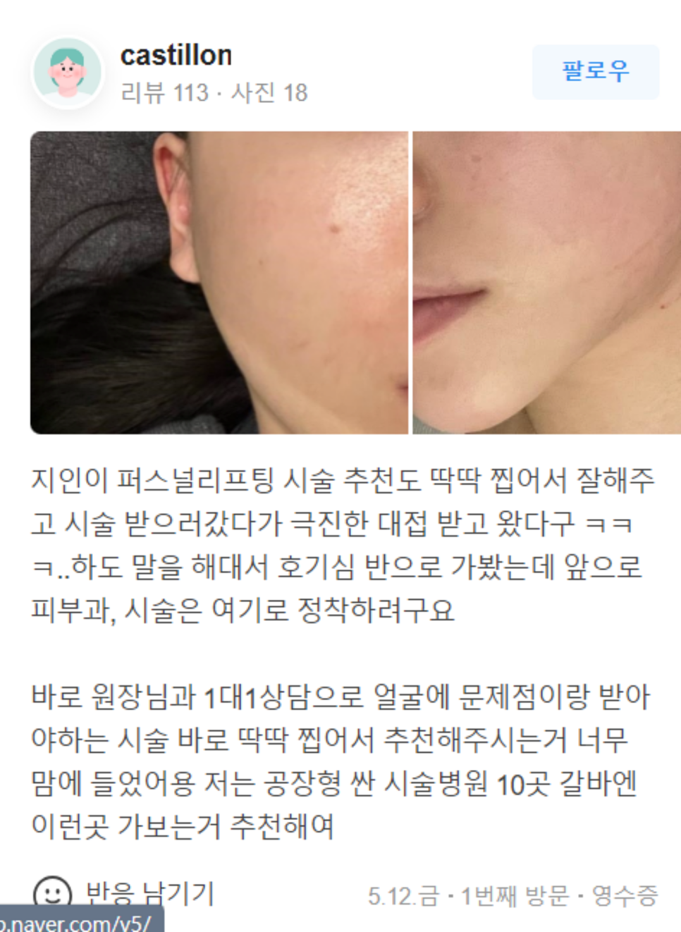 남자입술필러 자연스럽게 잘생겨지는 비결! 관련 이미지 8