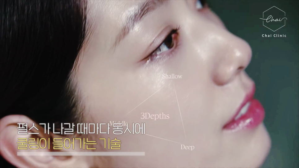 Hongdae Cerf: If You're Worried About Skin Condition Declining During the Rainy Season image 7