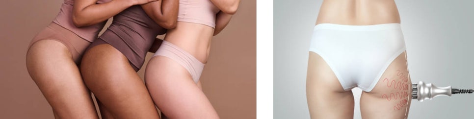 서대문구 피부관리, 늘어진 팔뚝라인 이제 안녕! 관련 이미지 9