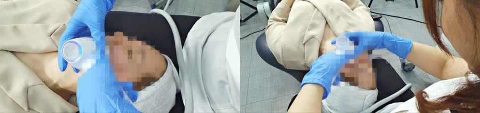 울쎄라 인모드 차이 피부 맛집은 바로 여기! 관련 이미지 4