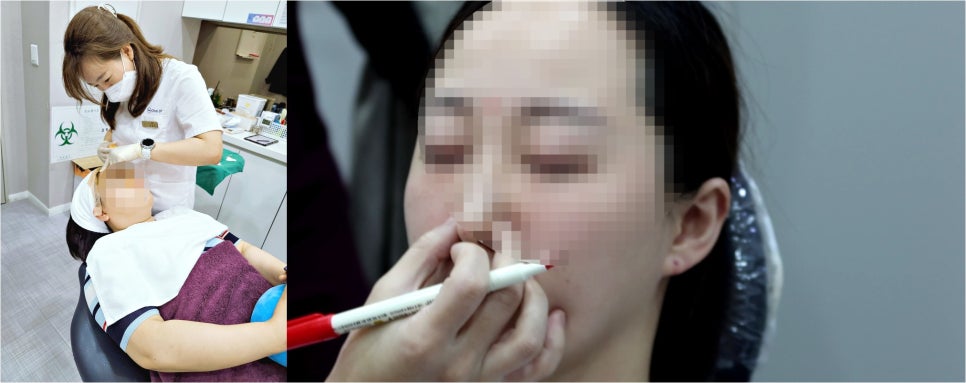 국산필러종류 무엇으로 선택할지 고민될 때! 관련 이미지 8