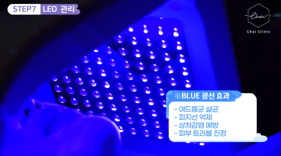 LDM물방울리프팅 효과 수분은 물론 탄력까지 찾아드려요 관련 이미지 13