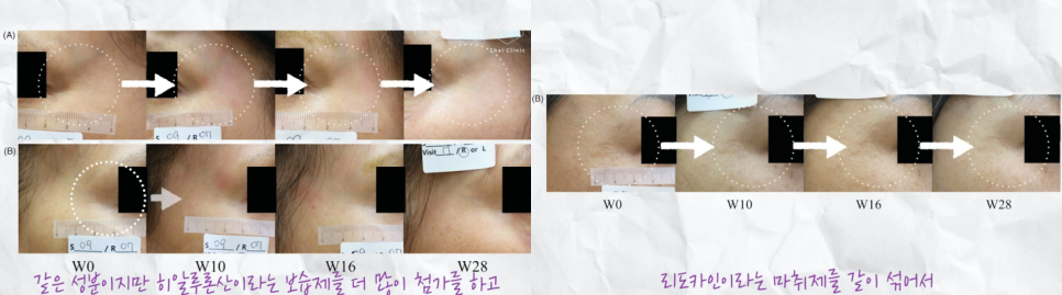합정동 피부관리 동안피부로 되돌리는 시술 조합 추천! 관련 이미지 9