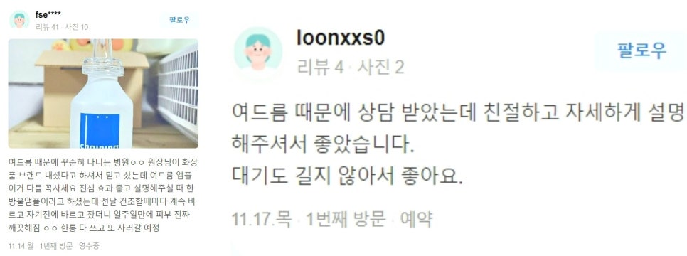처진볼살리프팅 관련 이미지 17