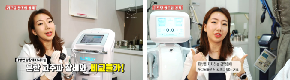 V라인리프팅, 일상생활 걱정 하지마세요! 관련 이미지 7
