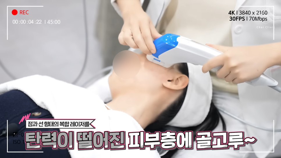 합정 슈링크 원리 효과 울쎄라보다 오래갈까? 관련 이미지 4