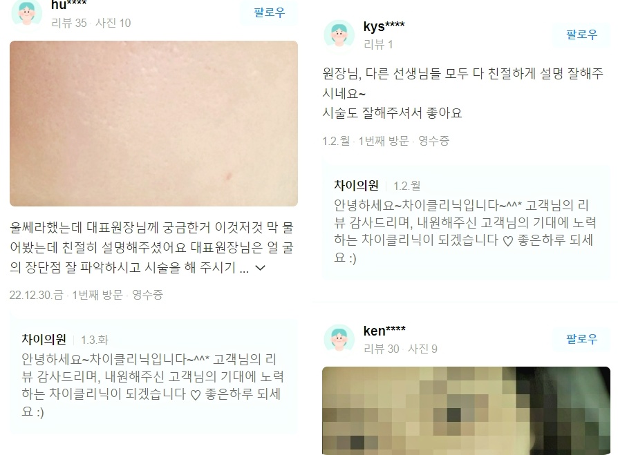 처진볼살리프팅 관련 이미지 9