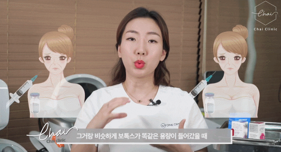 턱보톡스, 내성 없이 유지되는 이유 관련 이미지 5