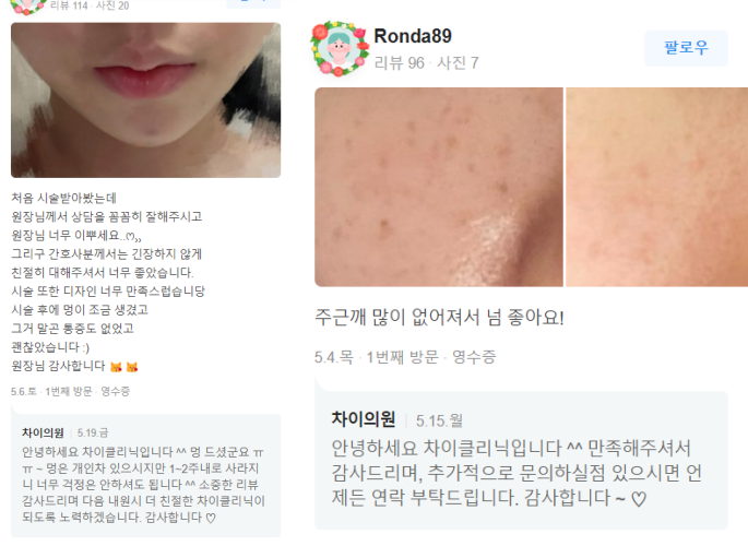 홍대보톡스잘하는곳 부작용에 대한 진실 밝혀드립니다! 관련 이미지 14