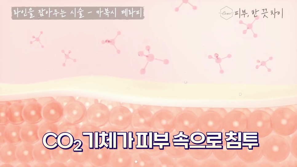 홍대 다이어트, 군살 쉽게 빼는 다이어트 시술 6가지 관련 이미지 11