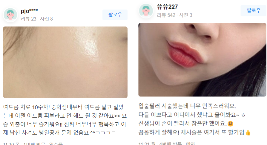 얼굴 빽빽하게 뒤덮은 사마귀 레이저로 박살 내기 관련 이미지 13