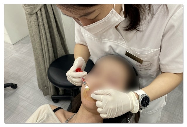 Three Things to Avoid for Safety After Filler Procedures image 7