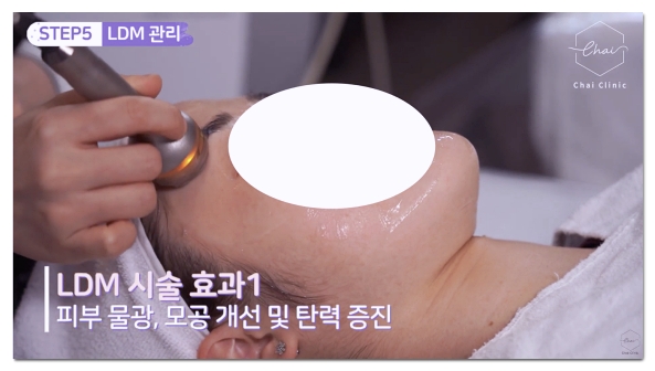 합정 피부관리, 관리실이랑 피부과 가격 차이가 왜 이렇게 클까? 관련 이미지 3