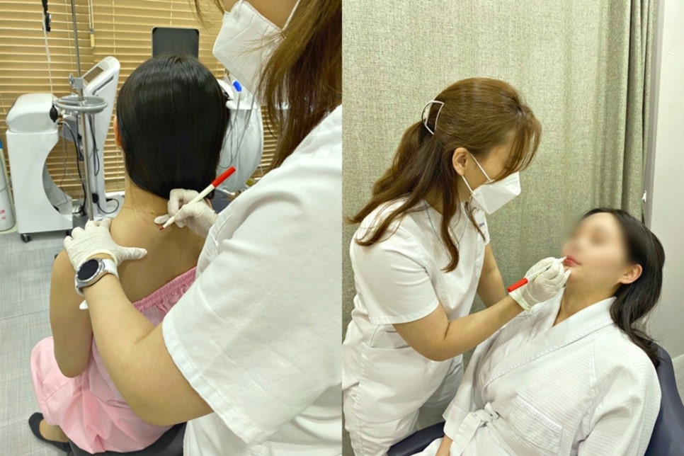 남자턱보톡스 OOO을 고려해야 관련 이미지 11