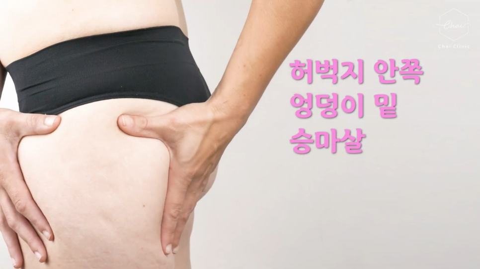 허벅지안쪽살주사 ‘이것’ 이 효과적이라는 사실을 알아야 관련 이미지 7