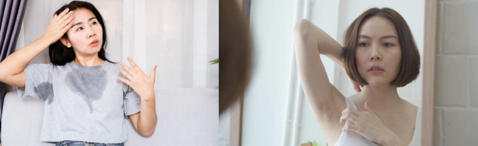 겨드랑이보톡스 다한증 치료에 효과적! 관련 이미지 3