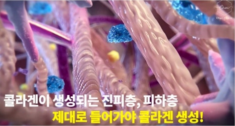볼꺼짐필러, 자연스럽게 얼굴 볼륨을 높이는 비결 관련 이미지 7