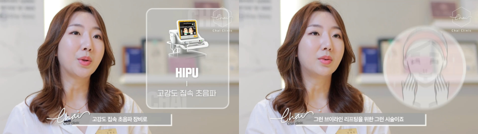 눈꼬리 올리기의 최강자, 아이 울쎄라 vs 아이 써마지 관련 이미지 3