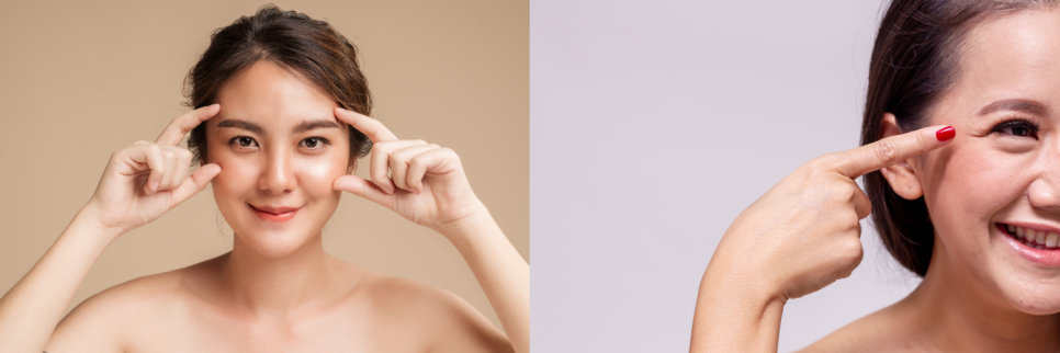 눈꼬리 올리기의 최강자, 아이 울쎄라 vs 아이 써마지 관련 이미지 2