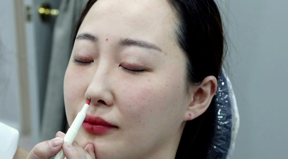 홍대필러 자연스럽고 예쁜 동안 입술 관련 이미지 6