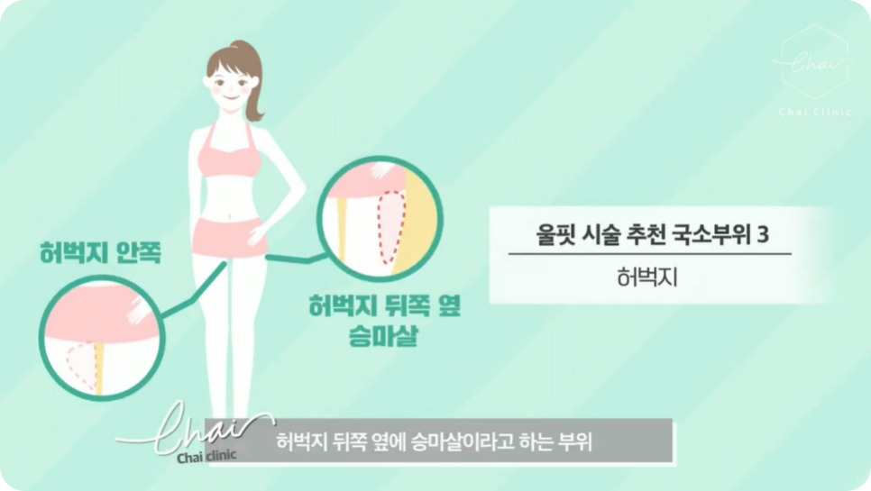 바디울핏 탄력있는 라인으로 여름뽀개기! 관련 이미지 7
