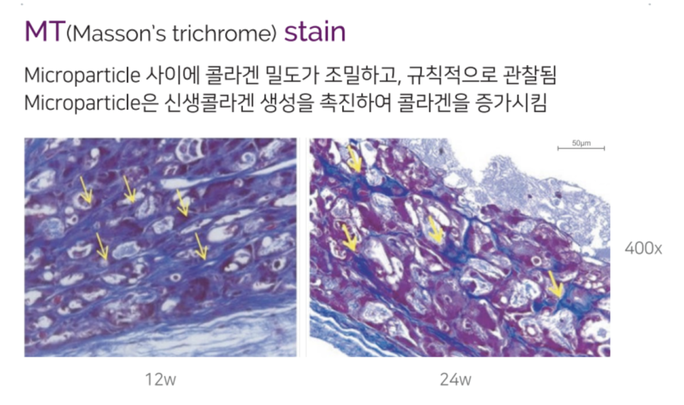 홍대 쥬베룩 볼륨의 개선 효과 관련 이미지 10