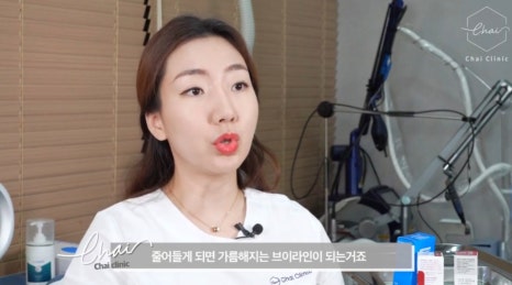 광대보톡스 달덩이 얼굴 이젠 안녕 관련 이미지 10