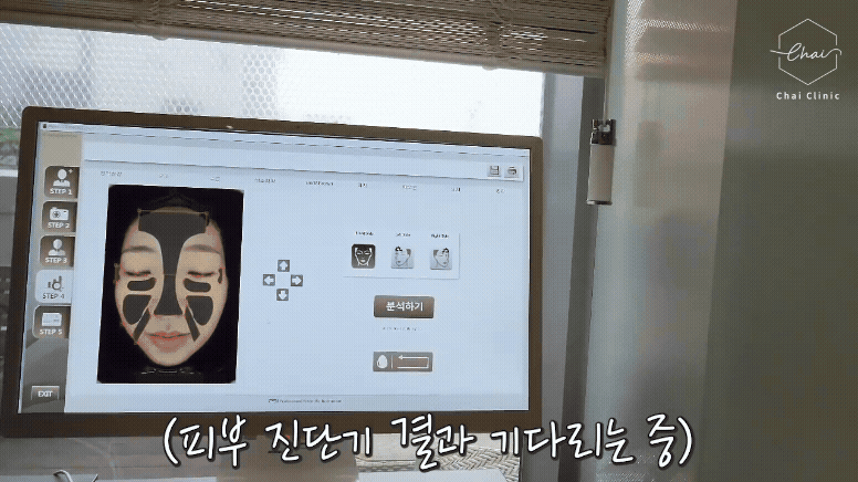 홍대 리쥬란 스킨부스터 의사의 내돈내산 후기 관련 이미지 14