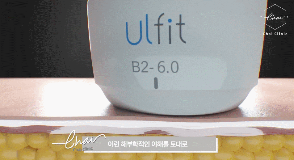 울핏 효과 및 추천 부위와 권장 횟수는? 관련 이미지 5