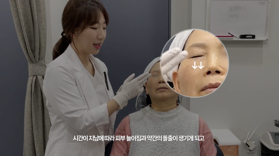 눈밑 쥬베룩 볼륨의 효과와 유지기간 관련 이미지 3
