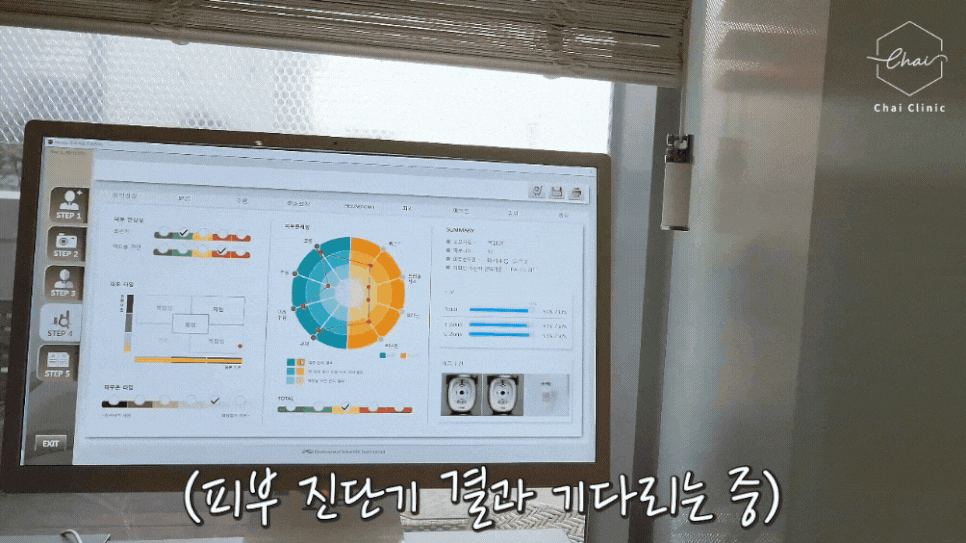 홍대 리쥬란힐러 잘하는 곳 2가지만 보세요 관련 이미지 4