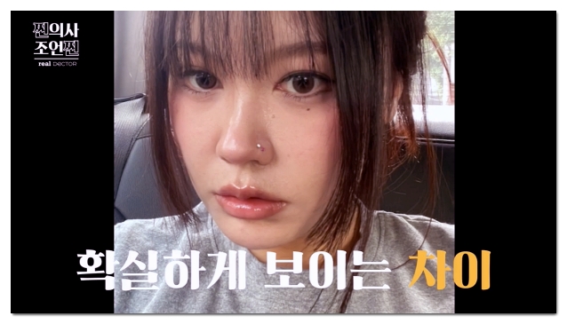 3 Characteristics of a Good Place for Lip Fillers in Hapjeong image 7
