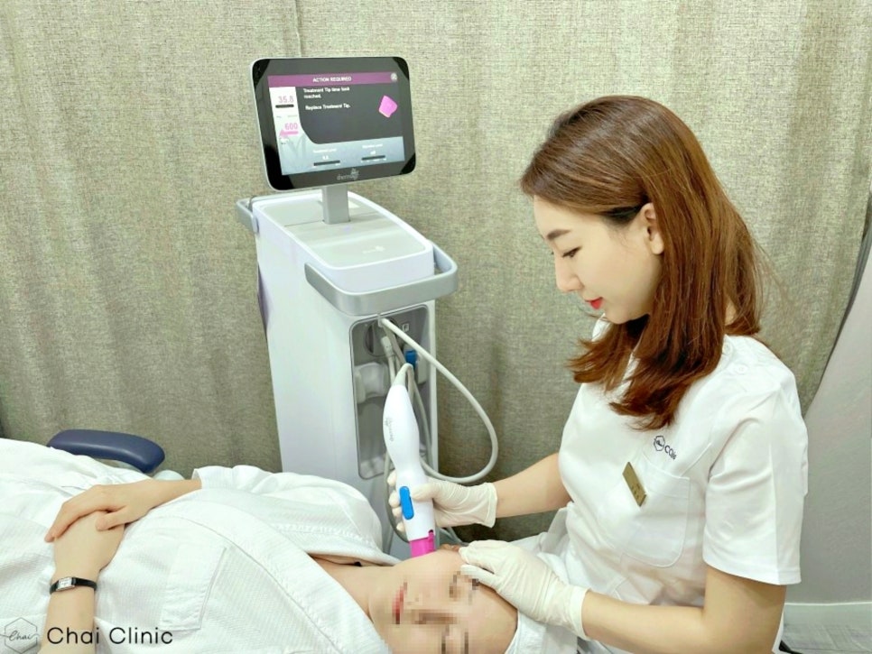 V라인리프팅 후기만 보고 결정하지 마세요! 관련 이미지 6