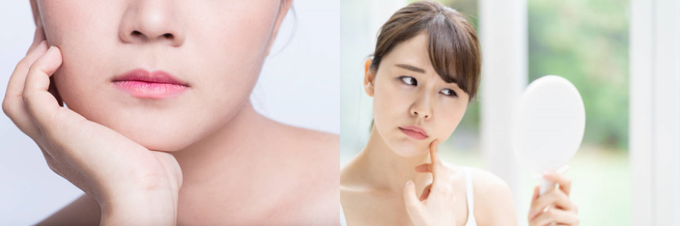 v라인사각턱 3분만 투자해 보세요. 관련 이미지 5