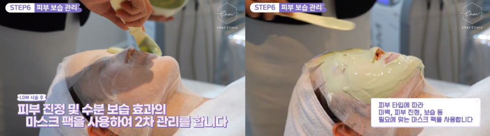 LDM물방울리프팅 효과 수분은 물론 탄력까지 찾아드려요 관련 이미지 11