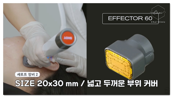 This Is How to Get a Hongdae XERF Consultation image 5