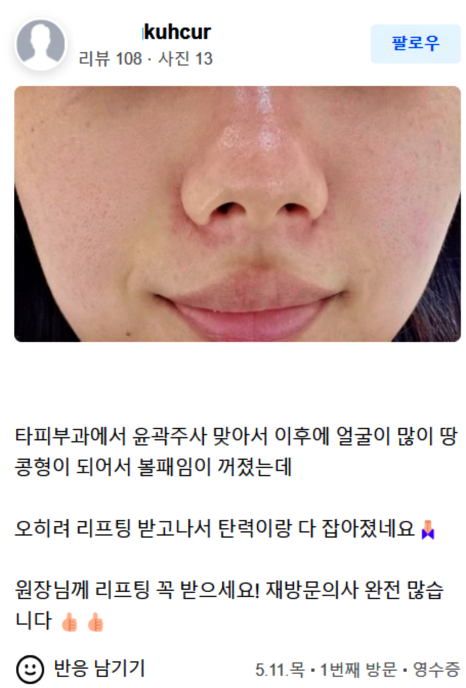 망원동피부관리, 여드름 흉터 지워드립니다 관련 이미지 14