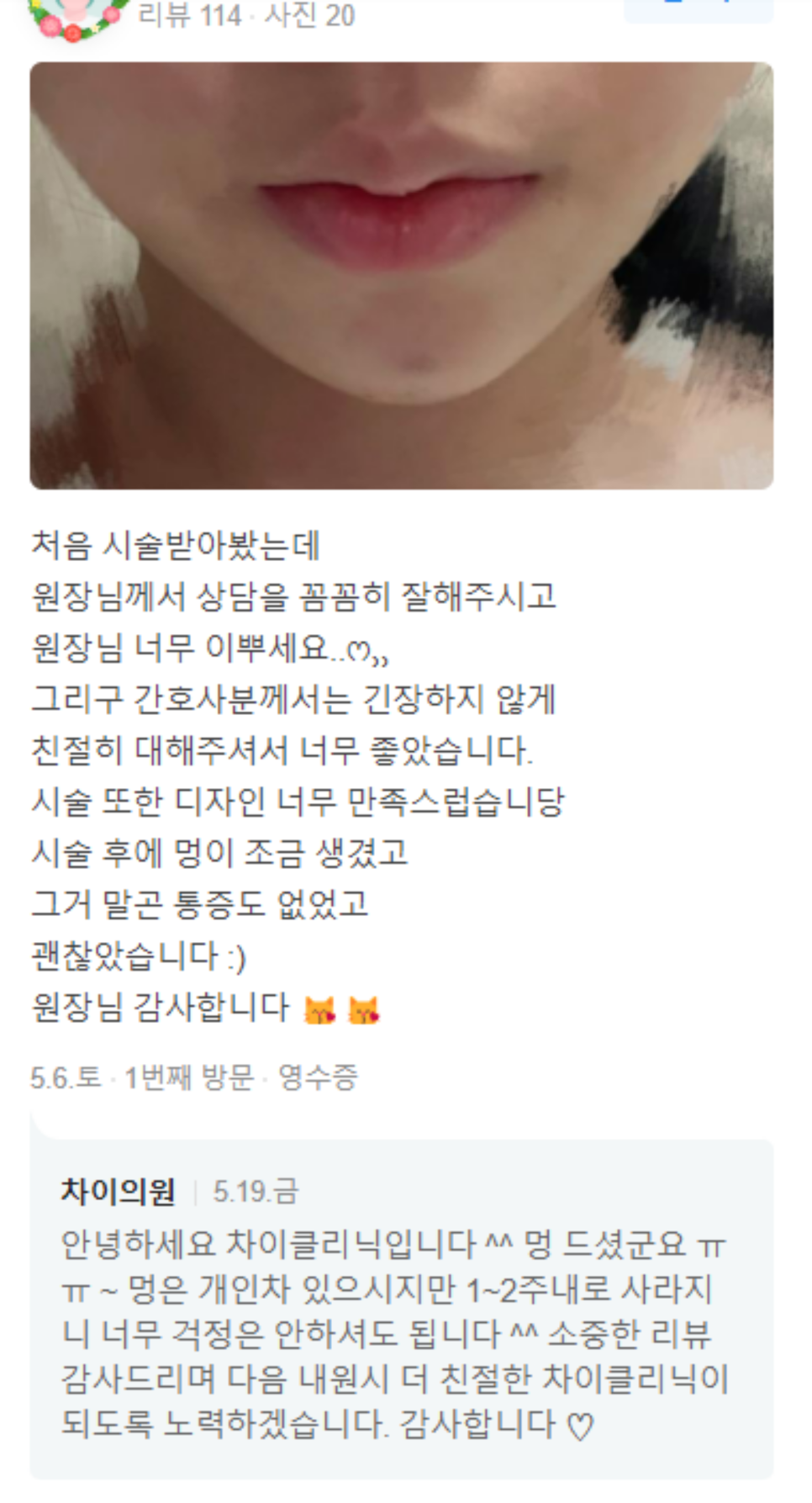 겨드랑이 레이저토닝 자신있게 핸즈업하려면 지켜야 할 것 관련 이미지 9