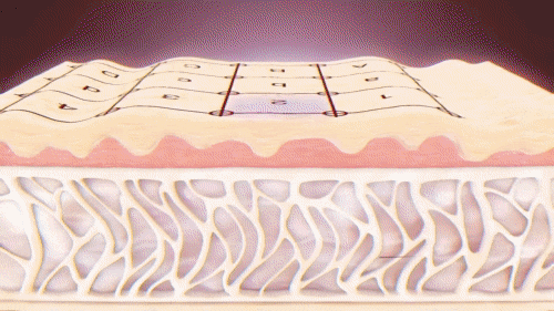 홍대 써마지, 후회 없는 시술을 원한다면 관련 이미지 3