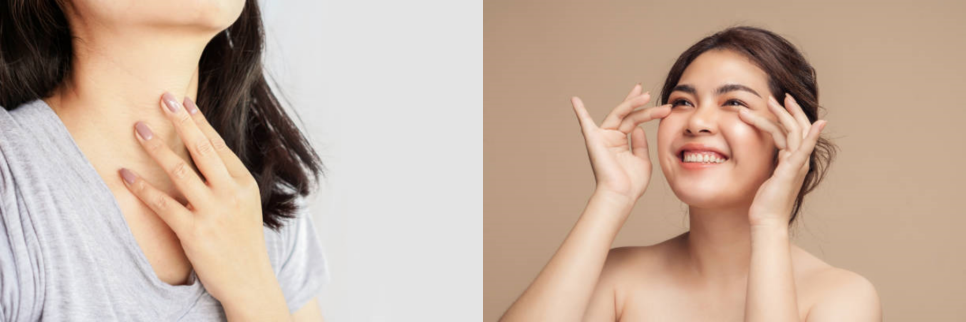아현역피부관리 풀페이스더모톡신 주름개선 대박이네요! 관련 이미지 8