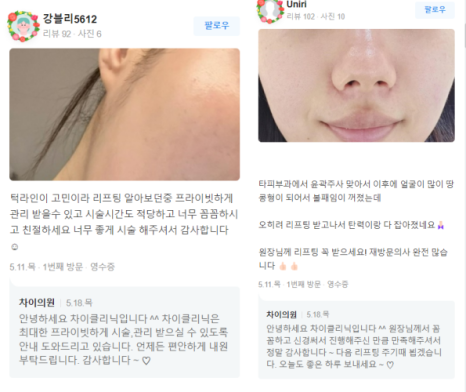 브이라인시술 매끄럽고 날렵한 라인으로! 관련 이미지 13