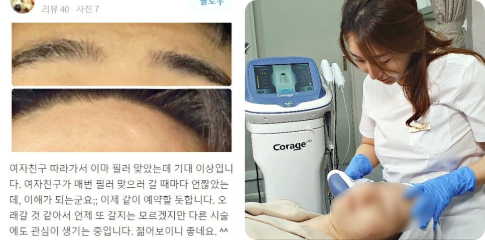 실루엣소프리프팅, 젊음의 생생함을 찾고 싶은 여러분에게 소개합니다. 관련 이미지 12
