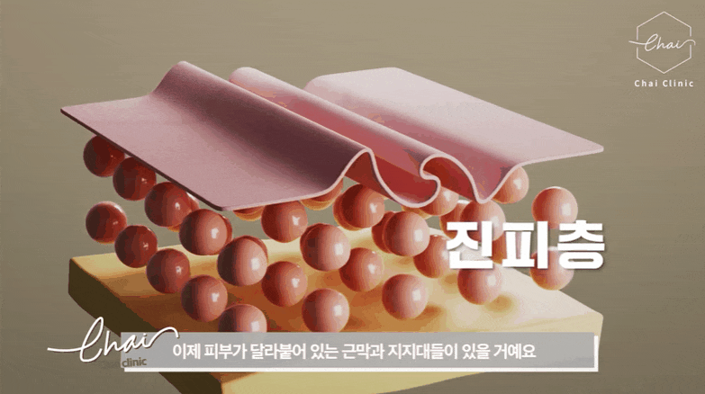 공덕역 피부관리 울쎄라 오래가는 리프팅 유지하기 관련 이미지 3