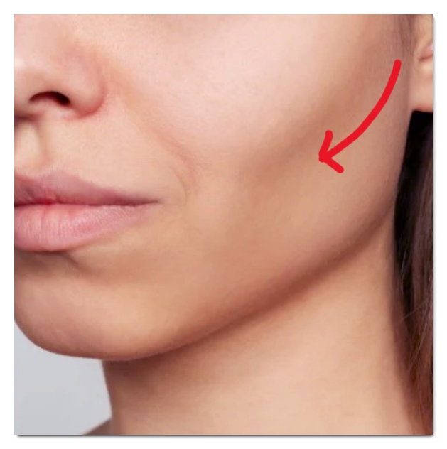 Three Major Side Effects of Hongdae Shurink and How to Fix Them image 4