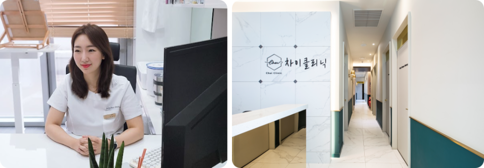 처진볼살리프팅 관련 이미지 1