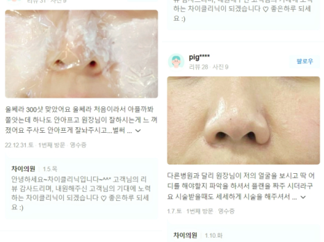 기미 레이저토닝 높은 효과는 OO에서 차이납니다. 관련 이미지 22