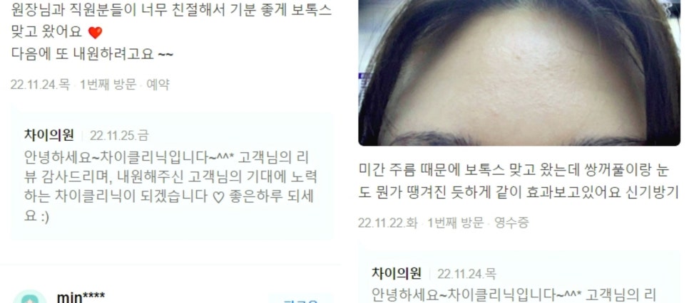 턱라인리프팅 시술 8년 차 원장이 추천하는 TOP2 관련 이미지 7