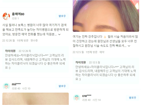 얼굴 리프팅 시술로 동안 완성! 관련 이미지 15