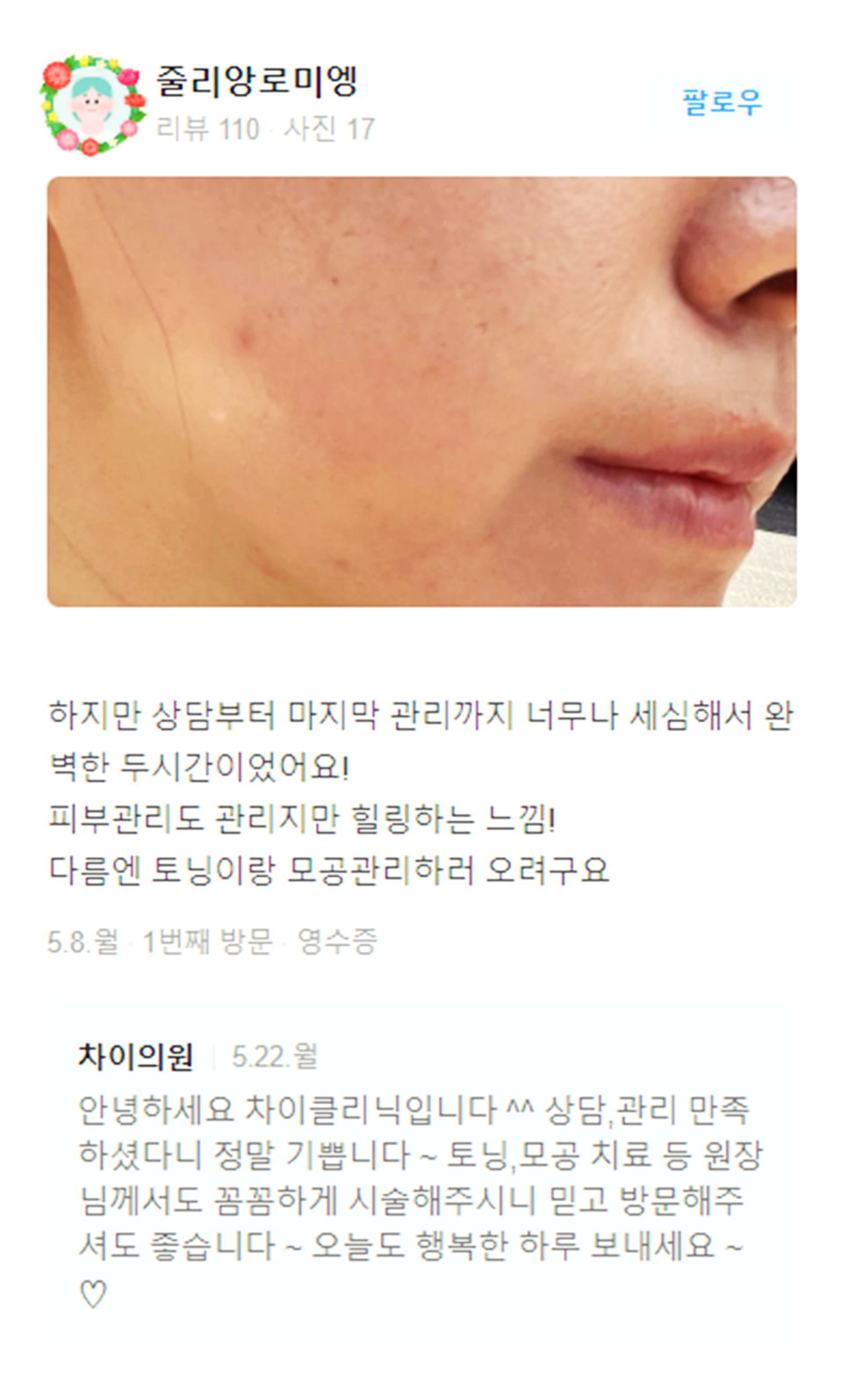 목주름레이저 타임머신효과, 탄력있는 목을 유지하세요! 관련 이미지 16